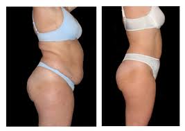 Méthode Unique, Rapide et Naturelle pour perdre du poids !